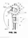 Fig. 05 - Control of a basket retrieval device