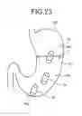 Fig. 19 - Capsule endoscope system