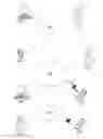 Fig. 01 - Quantifying a blood vessel reflection parameter of the retina