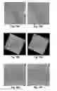 Fig. 10 - Quantifying a blood vessel reflection parameter of the retina