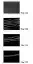 Fig. 11 - Quantifying a blood vessel reflection parameter of the retina