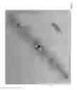 Fig. 04 - Body-worn sensor for characterizing patients with heart failure