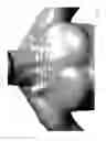 Fig. 06 - Body-worn sensor for characterizing patients with heart failure