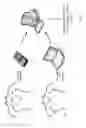 Fig. 10 - Body-worn sensor for characterizing patients with heart failure