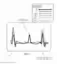 Fig. 06 - Detection and display of irregular periodic waveforms