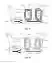 Fig. 08 - Atrial fibrillation treatment systems and methods