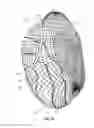 Fig. 16 - Atrial fibrillation treatment systems and methods