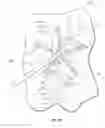 Fig. 41 - Atrial fibrillation treatment systems and methods