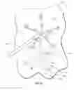 Fig. 44 - Atrial fibrillation treatment systems and methods