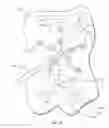Fig. 50 - Atrial fibrillation treatment systems and methods