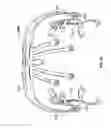 Fig. 29 - Systems and methods to gather and analyze electroencephalographic data