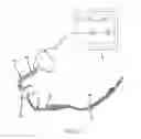 Fig. 09 - Radiolucent electrode or sensor assembly