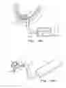 Fig. 04 - SYSTEM AND METHOD FOR REAL TIME TRACKING AND MODELING OF SURGICAL SITE
