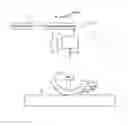 Fig. 01 - Contact-angle measurement method, contact-angle measurement device, bioprosthetic-member inspection device, and storage medium