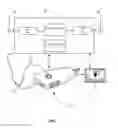 Fig. 08 - System and method for determining WHO grading of hearing impairment