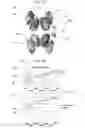 Fig. 05 - MAGNETIC RESONANCE IMAGING TOOL TO DETECT CLINICAL DIFFERENCE IN BRAIN ANATOMY