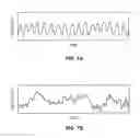 Fig. 09 - Method and apparatus for providing biofeedback during meditation exercise