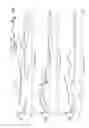 Fig. 29 - Muscular-skeletal joint stability detection and method therefor