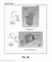 Fig. 06 - Membrane and balloon systems and designs for conduits