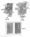 Fig. 16 - Membrane and balloon systems and designs for conduits