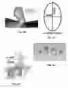 Fig. 25 - Membrane and balloon systems and designs for conduits