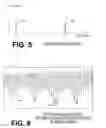 Fig. 05 - Filtering patient signal also for ventilation artifacts