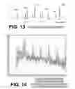 Fig. 11 - Filtering patient signal also for ventilation artifacts