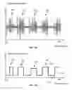 Fig. 16 - Method and Apparatus for Detecting and Classifying Seizures