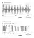 Fig. 17 - Method and Apparatus for Detecting and Classifying Seizures