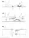 Fig. 02 - Device and method for assisting the aligning of a dockable patient support