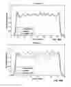 Fig. 12 - SYSTEM AND METHOD FOR EXPECTATION MAXIMIZATION RECONSTRUCTION FOR GAMMA EMISSION BREAST TOMOSYNTHESIS