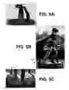 Fig. 09 - ViRPET—combination of virtual reality and PET brain imaging