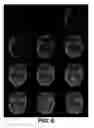 Fig. 10 - ViRPET—combination of virtual reality and PET brain imaging