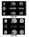 Fig. 12 - ViRPET—combination of virtual reality and PET brain imaging