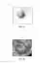 Fig. 03 - Method and system for defining a volume of interest in a physiological image