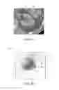 Fig. 04 - Method and system for defining a volume of interest in a physiological image