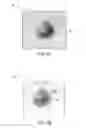 Fig. 08 - Method and system for defining a volume of interest in a physiological image