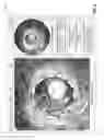 Fig. 07 - Devices, systems, and methods for in-stent restenosis prediction