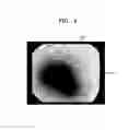 Fig. 06 - Ultrasound diagnostic apparatus and method of operating the same