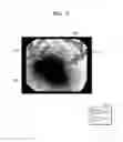 Fig. 07 - Ultrasound diagnostic apparatus and method of operating the same
