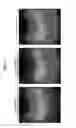 Fig. 08 - Ultrasonic diagnostic and image processing apparatus for tissue harmonic imaging by extracting nonlinear components from three signals via addition after phase rotation
