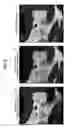 Fig. 09 - Ultrasonic diagnostic and image processing apparatus for tissue harmonic imaging by extracting nonlinear components from three signals via addition after phase rotation
