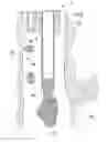 Fig. 01 - Body fluid collection device and endoscope system