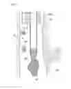 Fig. 04 - Body fluid collection device and endoscope system