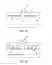 Fig. 02 - Implantable sealable member with mesh layer