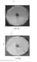 Fig. 05 - Implantable sealable member with mesh layer