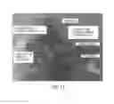 Fig. 14 - Implantable sealable member with mesh layer
