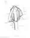 Fig. 28 - Intravascular devices, systems, and methods for the controlled dissection of body lumens