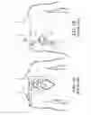 Fig. 02 - Surgical rib retractor and methods thereof