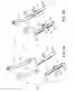 Fig. 07 - Surgical rib retractor and methods thereof